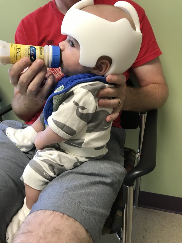 Feeding infant during his Doc Band Cranial Technologies appointment made easy with ready to drink formula